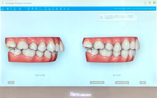 before-after